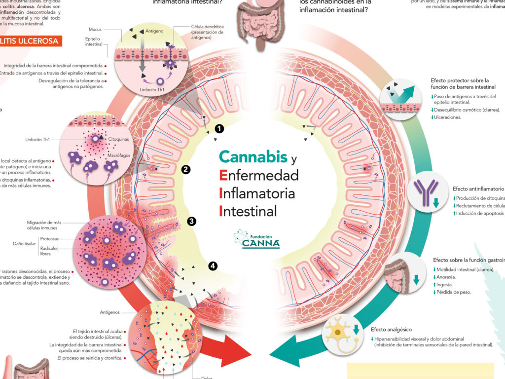 Infografía Médica Rigurosa Infografía científica sobre enfermedad inflamatoria intestinal y efectos del cannabis en el sistema digestivo.